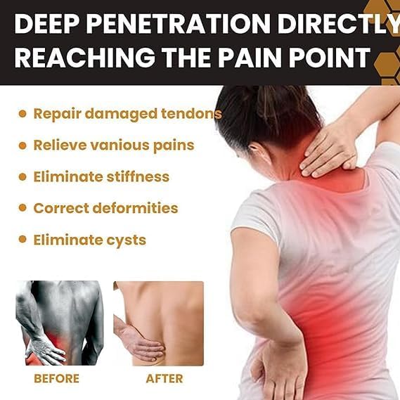 Bee Venom - Joint Soothing Gel (Original) - Zambeel