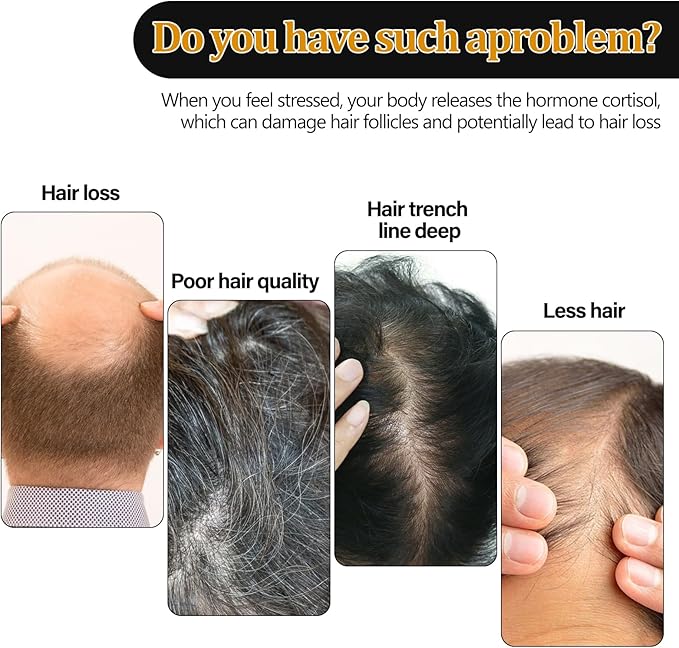 Eelhoe - Root Activation Shampoo (Original) - Zambeel