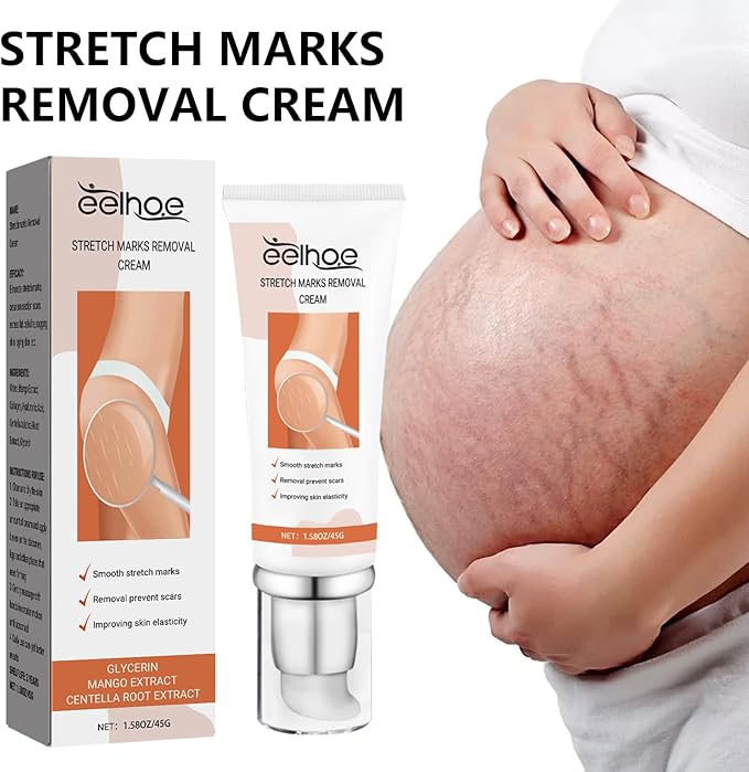 Eelhoe - Stretch Marks Removal Cream (Original) - Zambeel