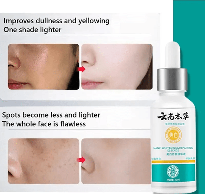 Hanxi - Whitening & Repairing Essence (Original) - Zambeel