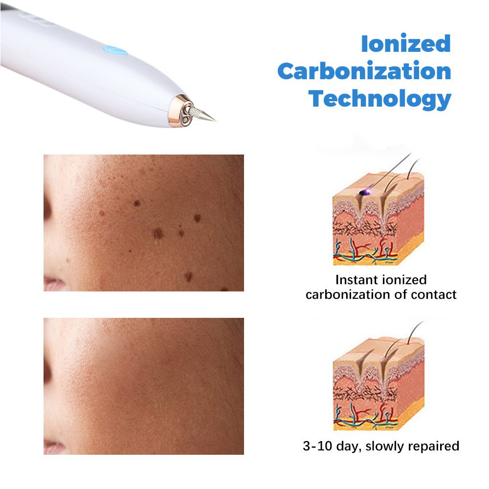 Laser Skin Tag Remover Face Mole Remove Plasma Pen Freckle Removal Machine Plasma Remove Scar Black Spot Face Wart Tattoo Device - Zambeel