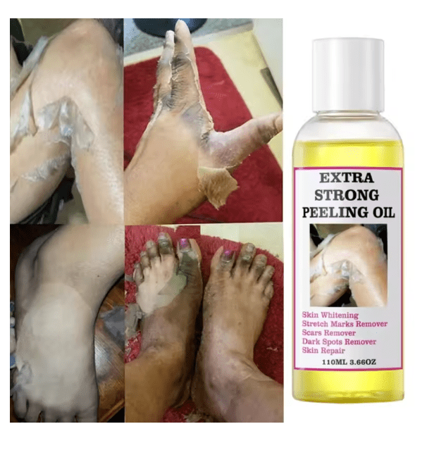 Peeling Oil (110ml) - Zambeel