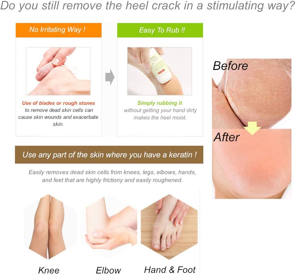 Purederm - Moisturizing Heel Crack Remover (Original) - Zambeel