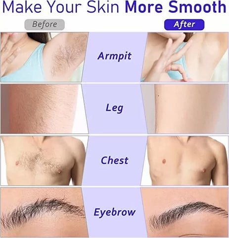 3 - in - 1 Roll - On Waxing Deal - Zambeel