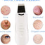 3 - in - 1 Ultrasonic Facial Skin Scrubber - Zambeel