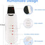 3 - in - 1 Ultrasonic Facial Skin Scrubber - Zambeel