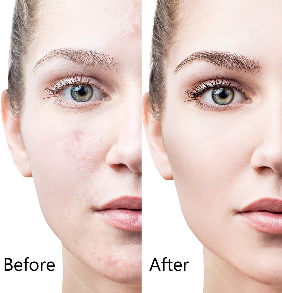 6 - in - 1 Derma Roller System - Zambeel