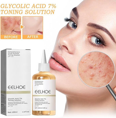 تونر لبشرة الوجه