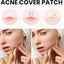 Acne Cover Patch (72pc) - Zambeel