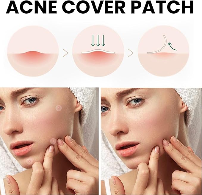 Acne Cover Patch (72pc) - Zambeel