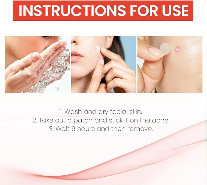 Acne Cover Patch (72pc) - Zambeel