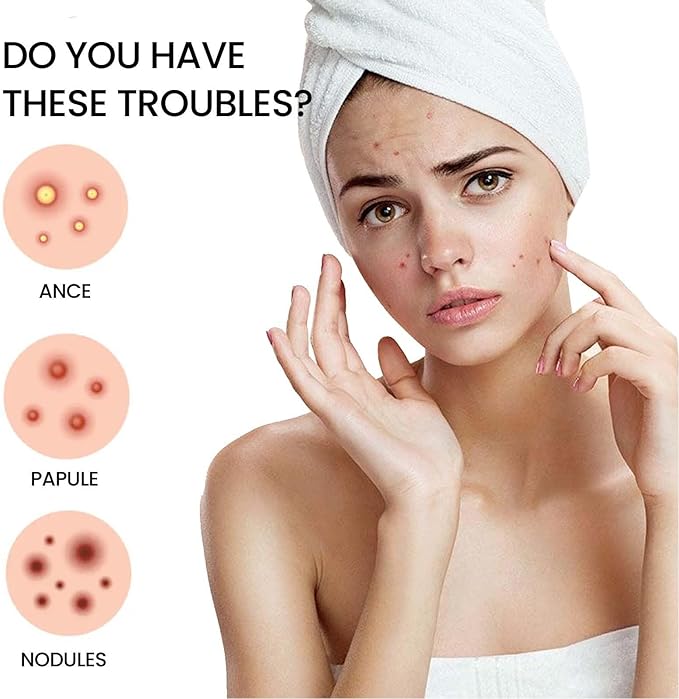 Acne Cover Patch (72pc) - Zambeel