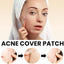 Acne Cover Patch (72pc) - Zambeel