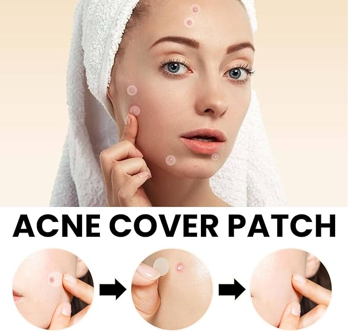 Acne Cover Patch (72pc) - Zambeel