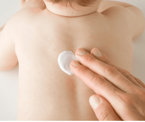 Aichun Beauty - Baby Care Nappy Rash Cream (Original) - Zambeel