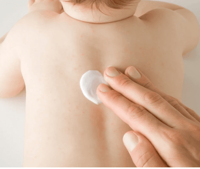 Aichun Beauty - Baby Care Nappy Rash Cream (Original) - Zambeel