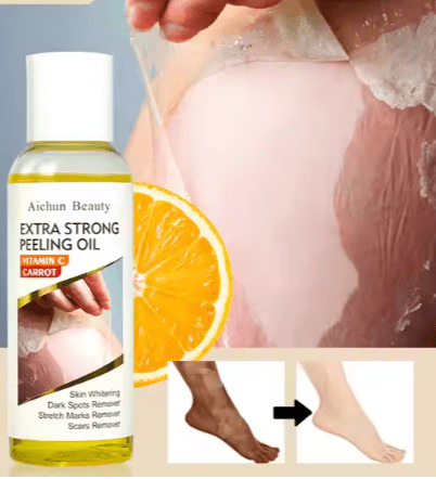 Aichun Beauty - Extra Strong Peeling Oil - Zambeel