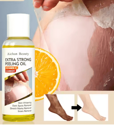 Aichun Beauty - Extra Strong Peeling Oil - Zambeel