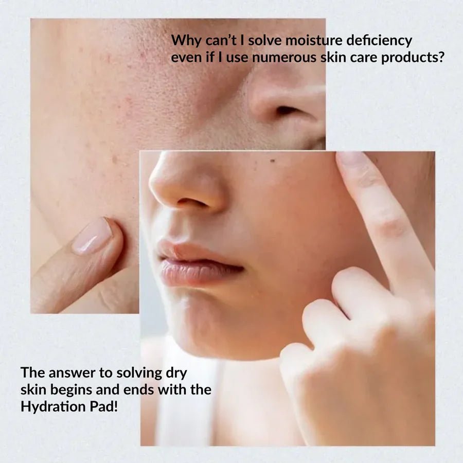 Anua - Birch Moisture Boosting Pad (Original) - Zambeel