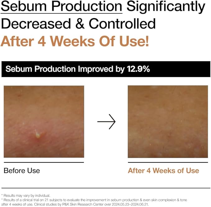 Anua - Rice 70 Glow Milky Toner (Original) - Zambeel