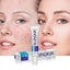 BIOAQUA - Acne Removing and Rejuvenating Cream (Original) - Zambeel