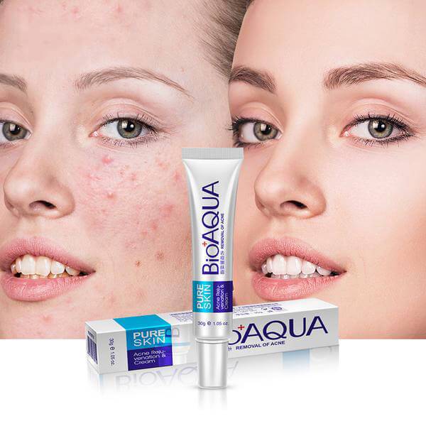 BIOAQUA - Acne Removing and Rejuvenating Cream (Original) - Zambeel
