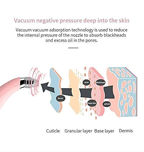 Blackhead Cosmetology Apparatus - Zambeel