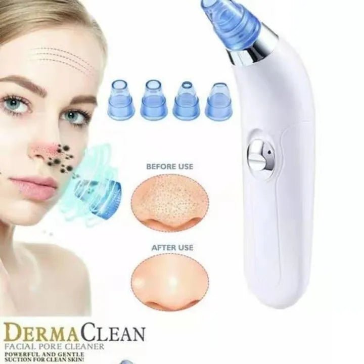 Blackhead Remover - Zambeel
