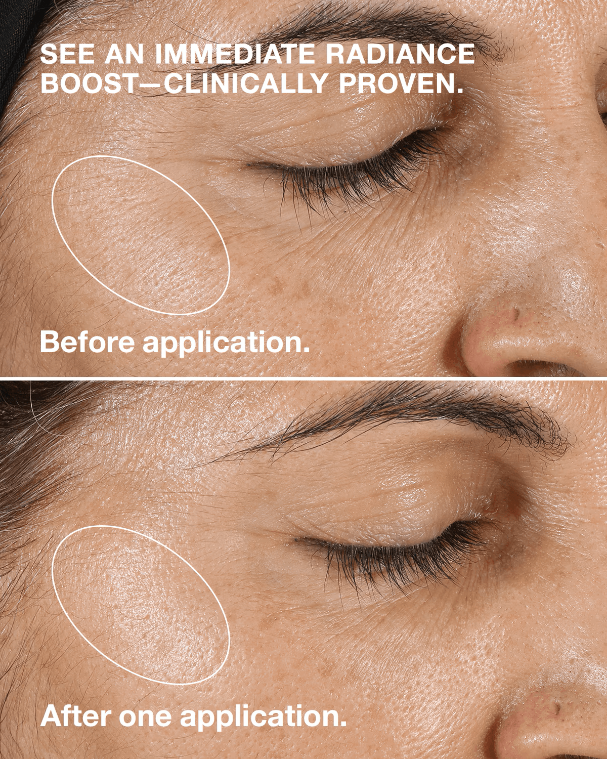 Clinique - Clarifying Lotion (Original) © - Zambeel