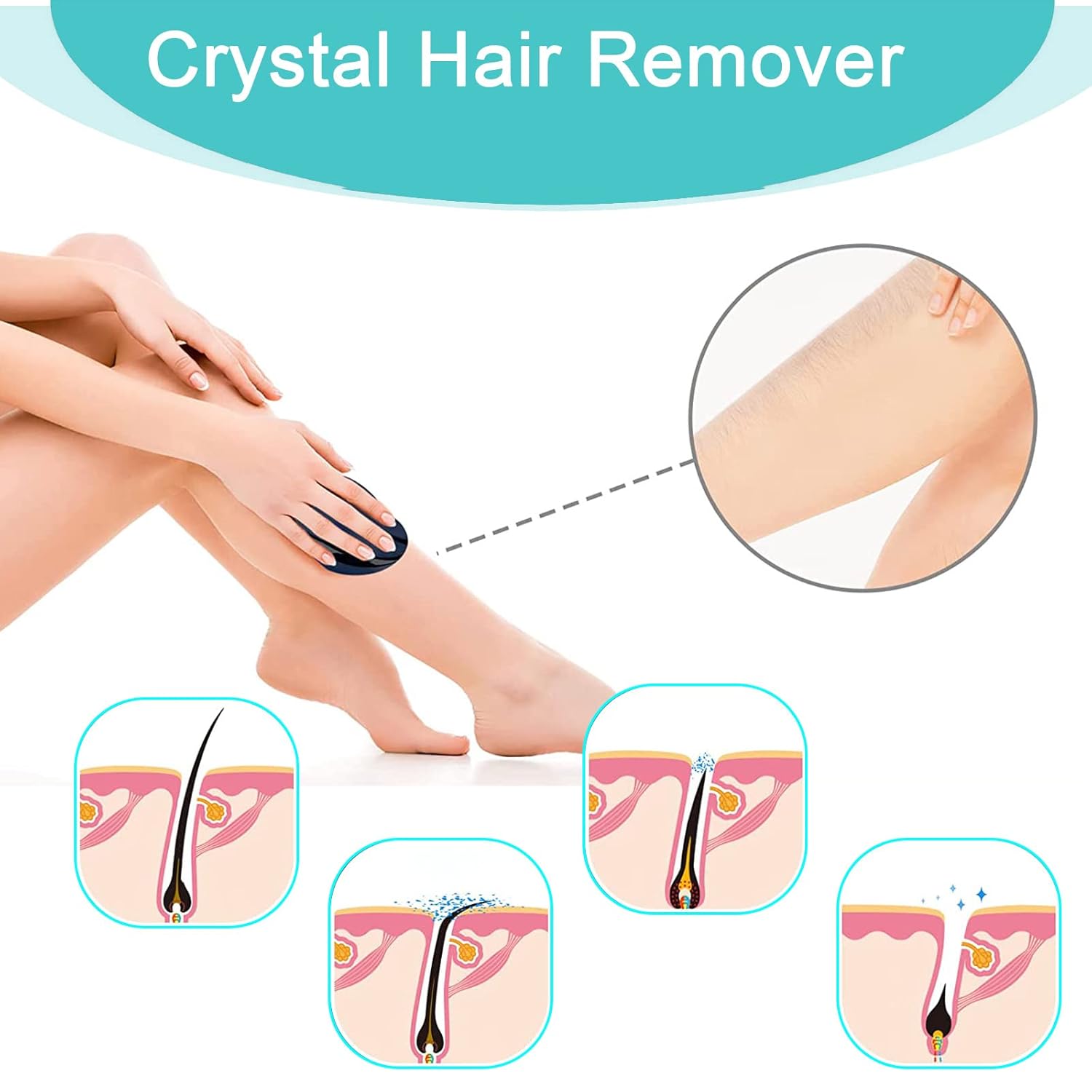 Crystal Hair Removal Tool - Zambeel