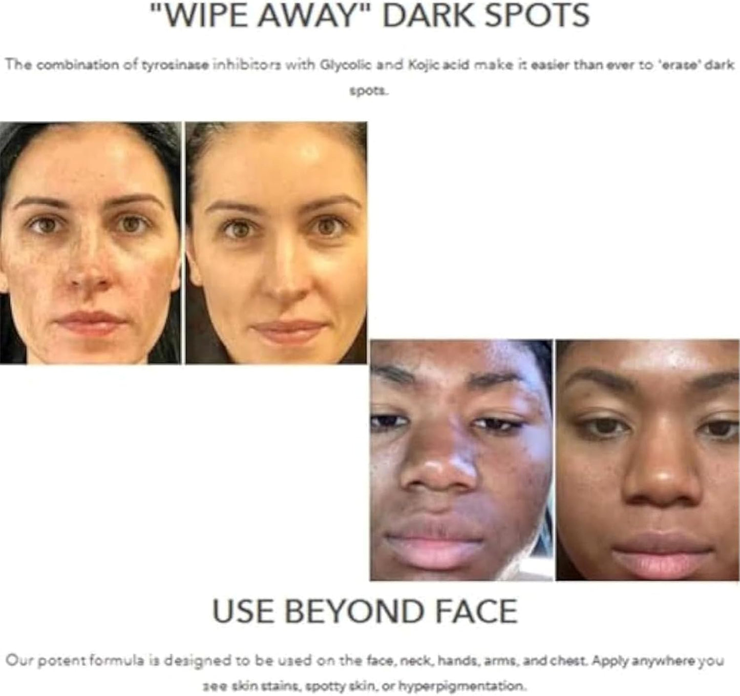 Dark Spot Repair Lotion (Original) - Zambeel