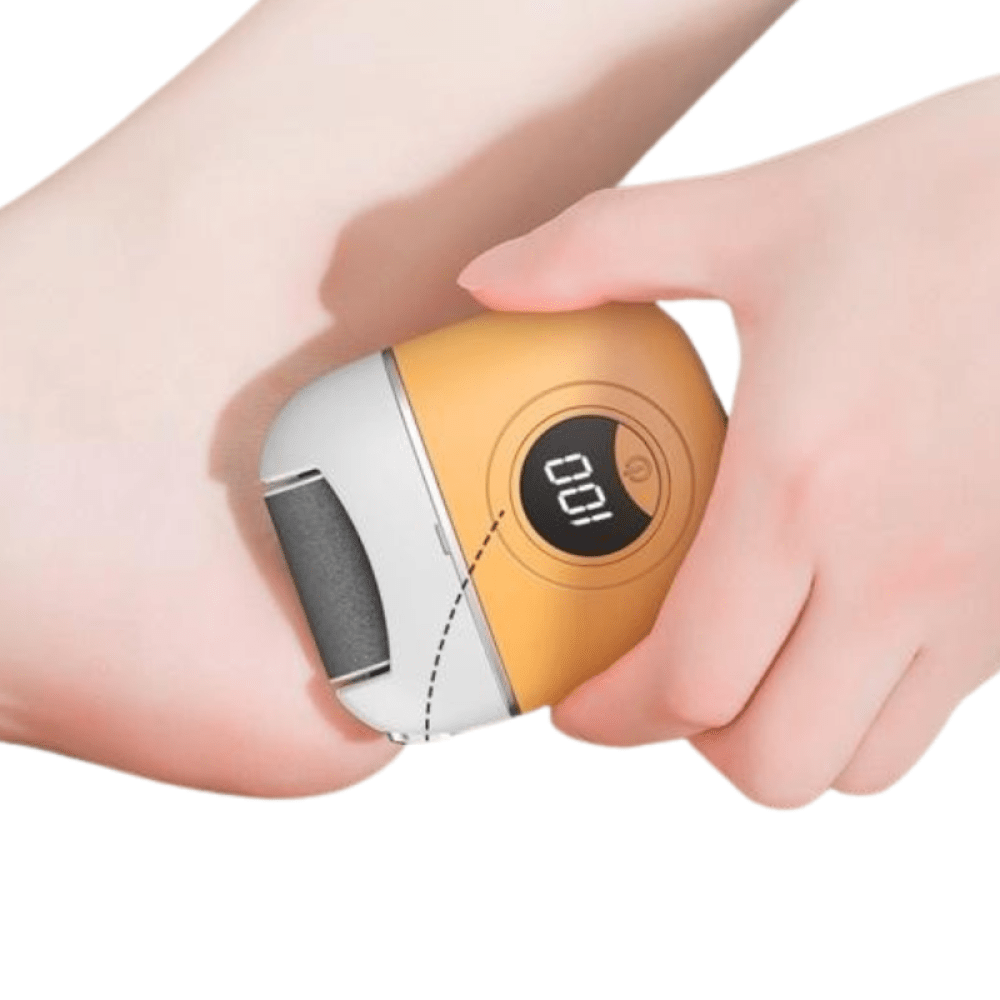 Denx - Foot Polisher - Zambeel