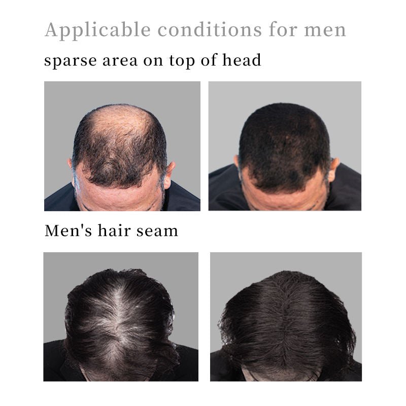 Dr Rashel - Hair Building Fibers - Zambeel