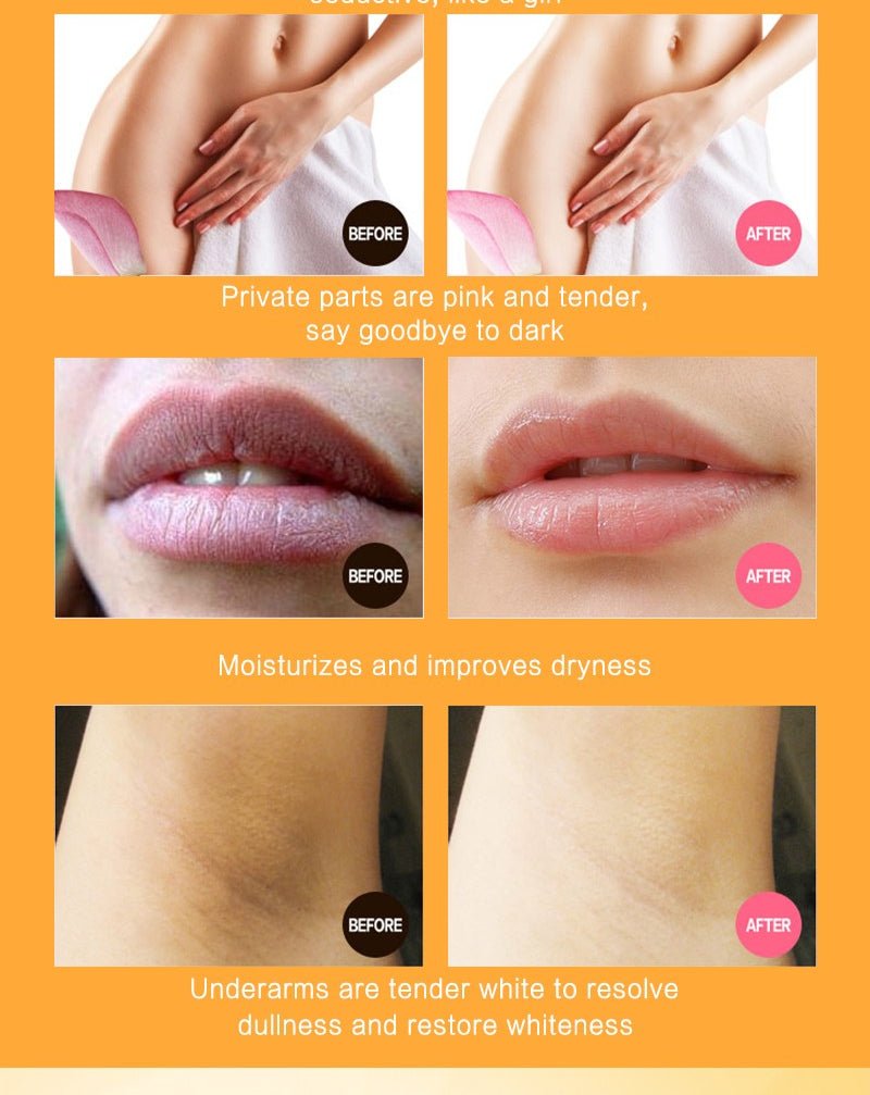 Dr Rashel - Vitamin C Privates Parts Whitening Cream - Zambeel