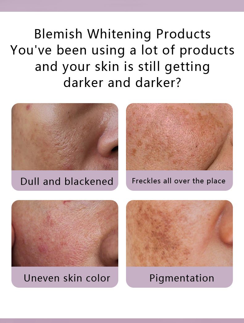 Dr. Rashel - Whitening Fade Spots Skin Care Mini Set - Zambeel