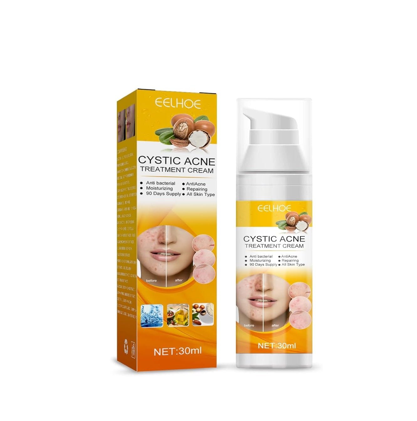 Eelhoe - Cystic Acne Cream (Original) - Zambeel