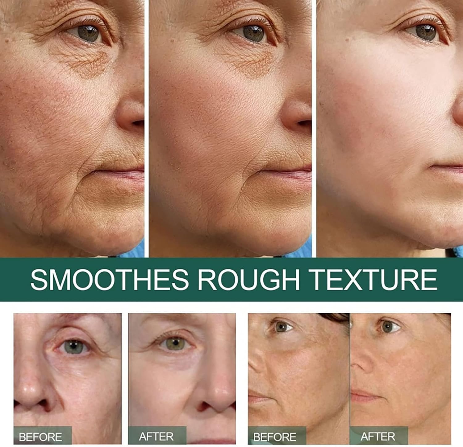 Eelhoe - Dark Spot Correcting Serum - Zambeel