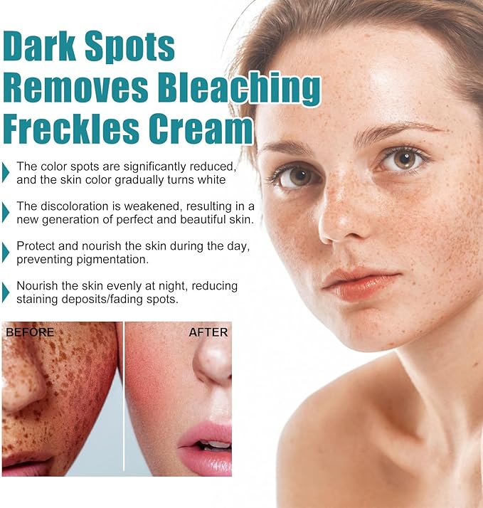 Eelhoe - Dark Spots Removes Cream (Original) - Zambeel