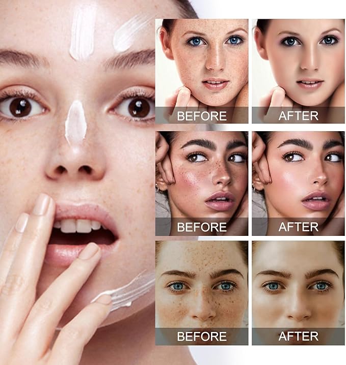 Eelhoe - Dark Spots Removes Cream (Original) - Zambeel