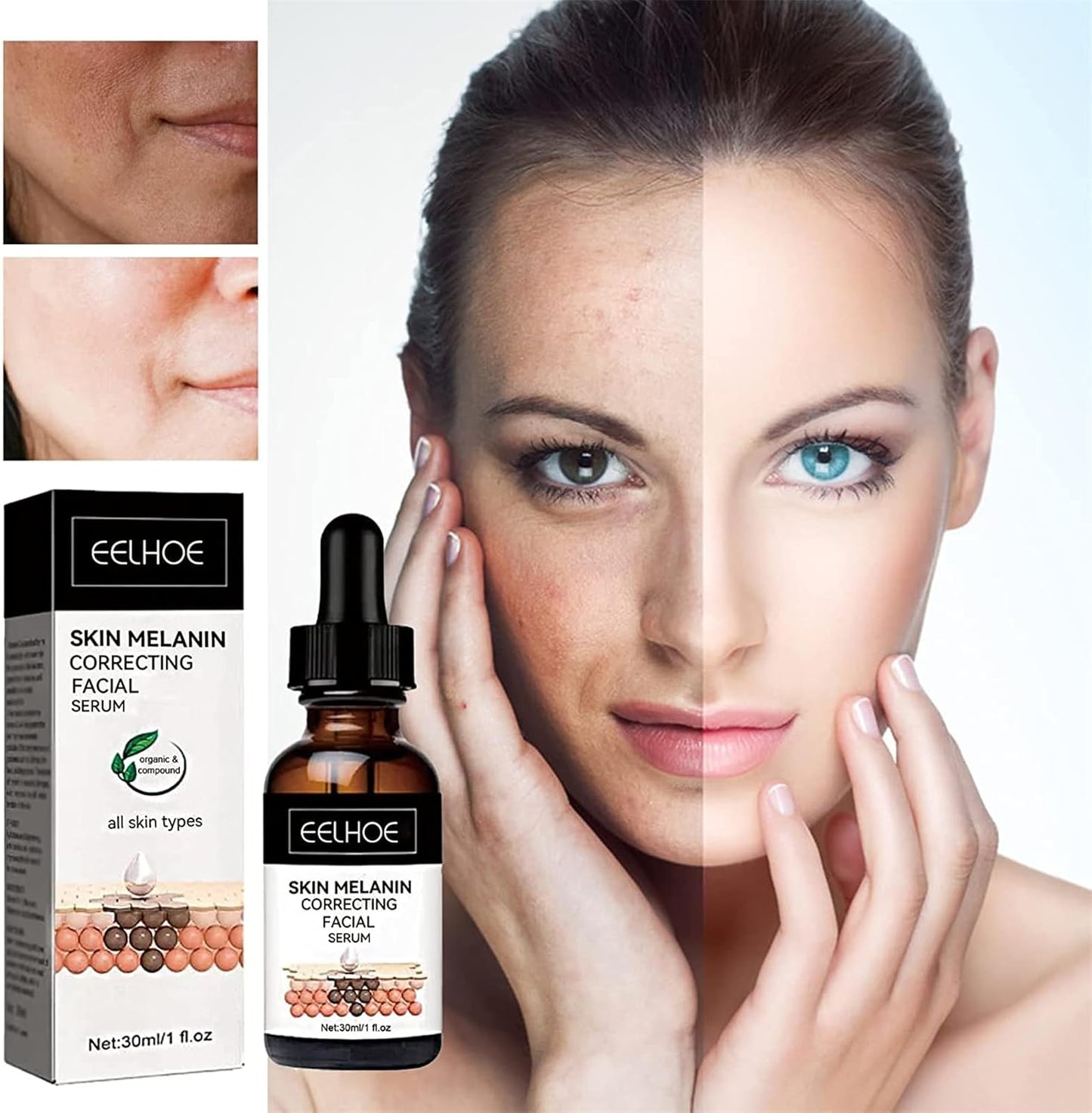 Eelhoe - Melanin Correcting Serum - Zambeel