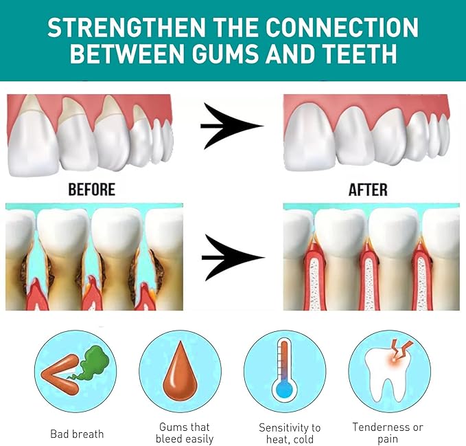 Eelhoe - Mouth Relief Spray (Original) - Zambeel