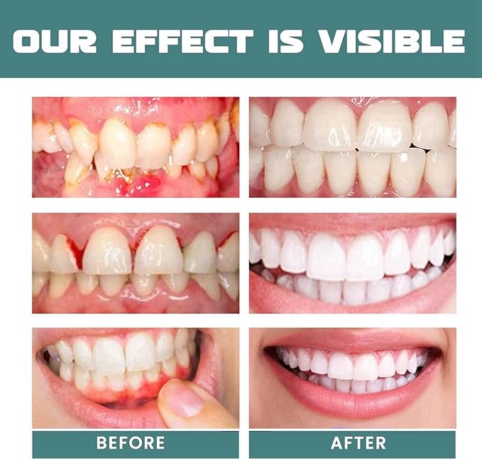 Eelhoe - Mouth Relief Spray (Original) - Zambeel