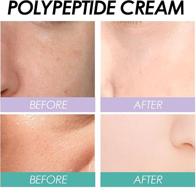 EELHOE - Polypeptide Cream (Original) - Zambeel