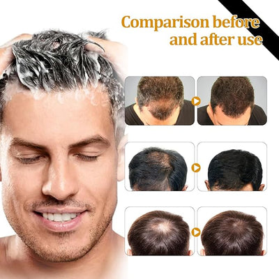 Eelhoe - Root Activation Shampoo (Original) - Zambeel