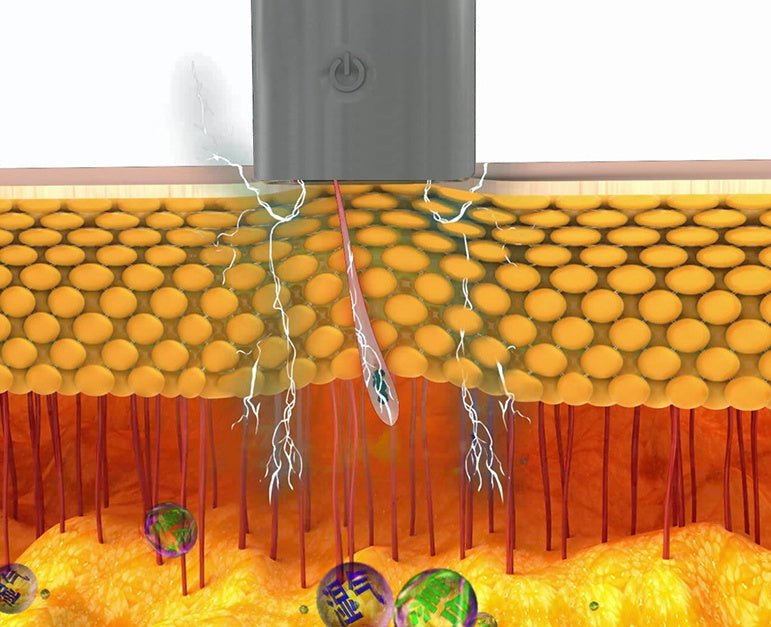 Electric Silicone Cupping Therapy Equipment Full Body Massage EMS Pulse Massager Suction Jar Pressure Vacuum Cupping Health Care - Zambeel