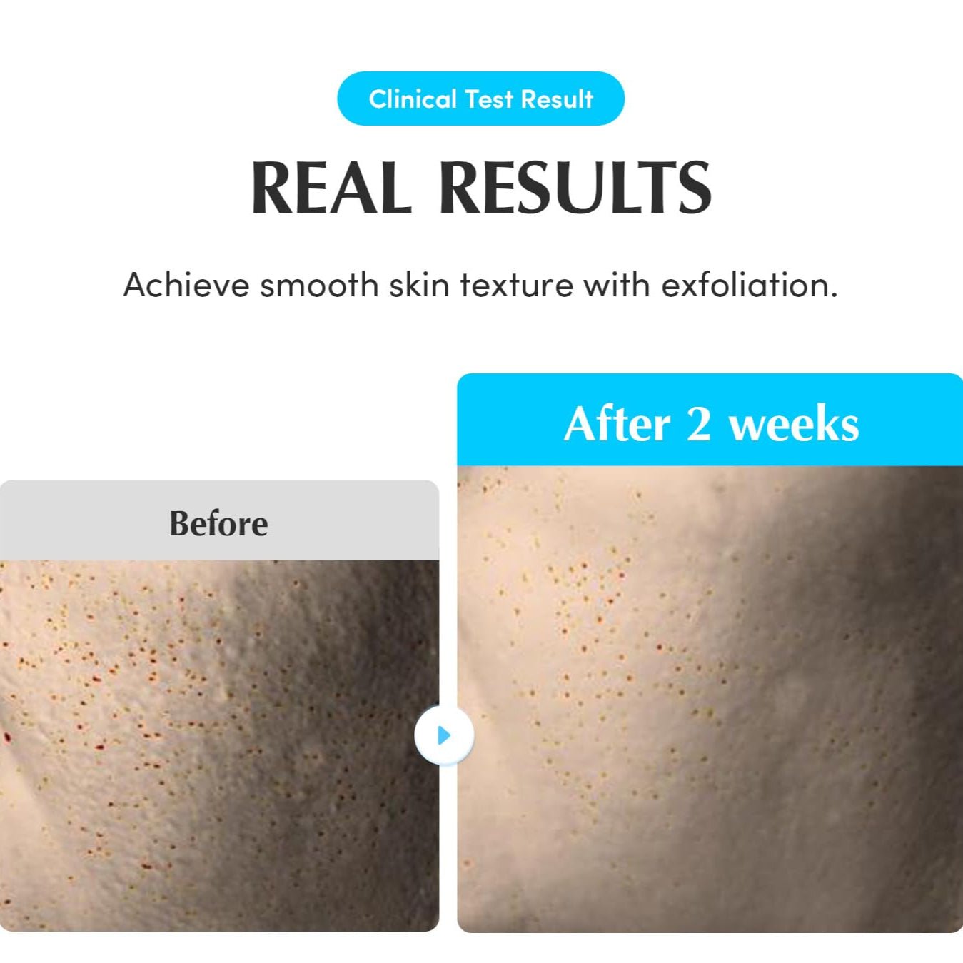 EQQUALBERRY - Swimming Pool Toner (Original) - Zambeel