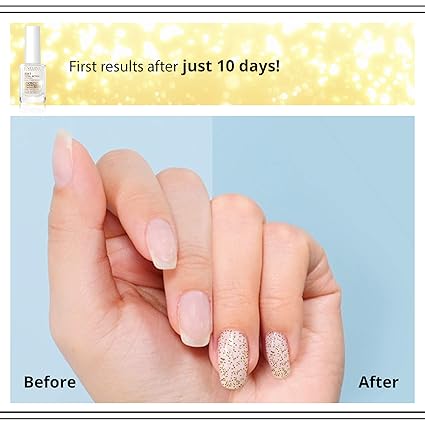 Eveline Cosmetics - 8 - in - 1 Nail Conditioner with Golden Particles (Original) - Zambeel