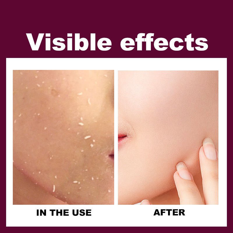 Exfoliating Gel Cream - Zambeel