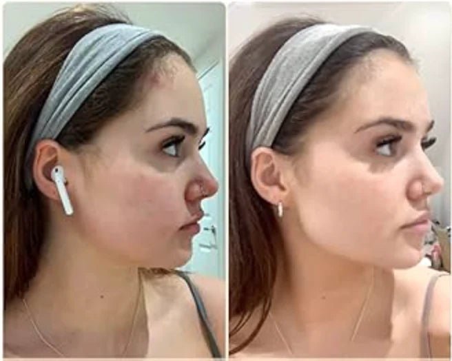 Face Massager © - Zambeel