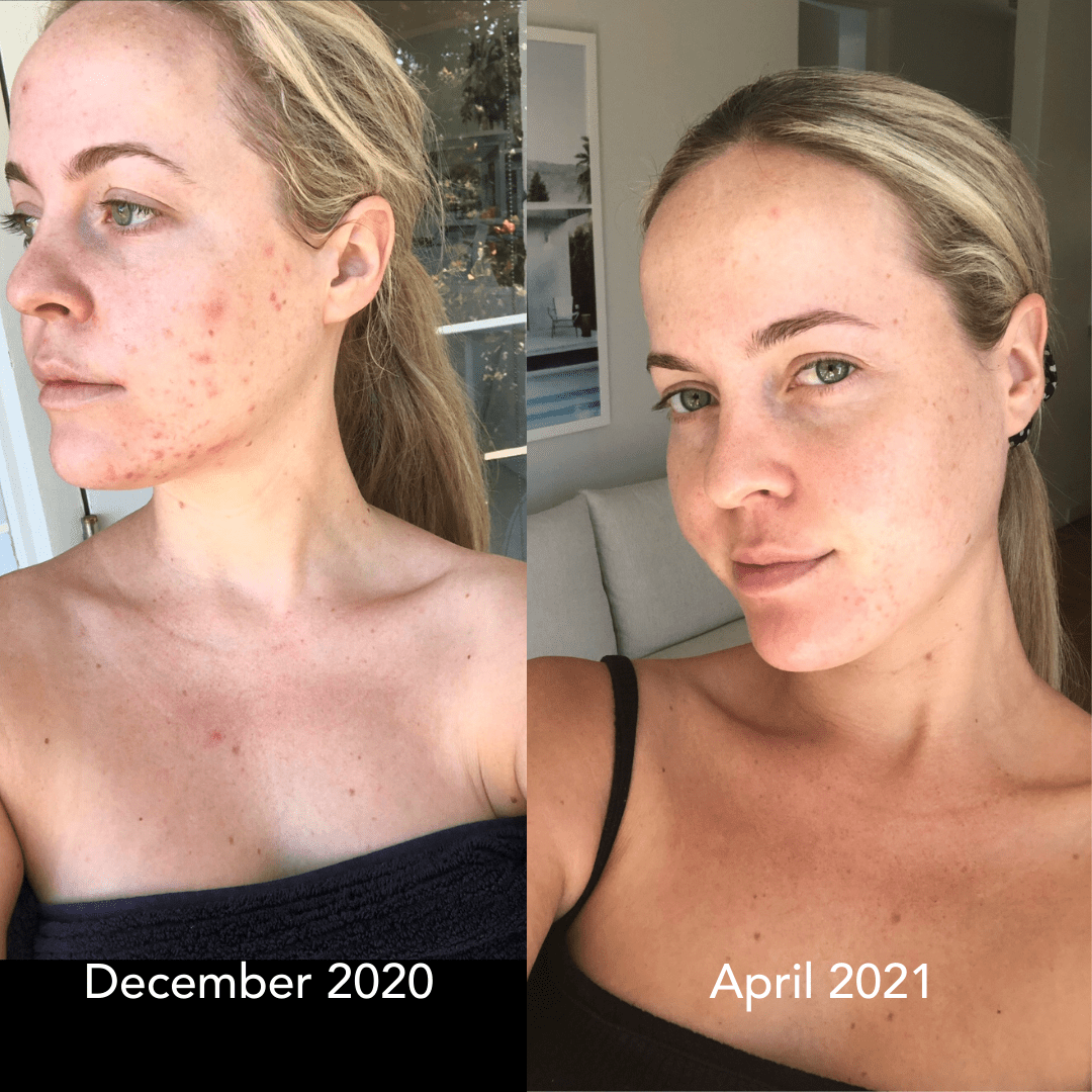 Face Massager © - Zambeel